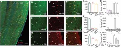 A Characterization of the Electrophysiological and Morphological Properties of Vasoactive Intestinal Peptide (VIP) Interneurons in the Medial Entorhinal Cortex (MEC)